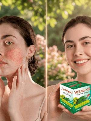 Before and after comparison showing model with skin rashes and acne turning into clear skin using NEEMFAIR Unani ointment